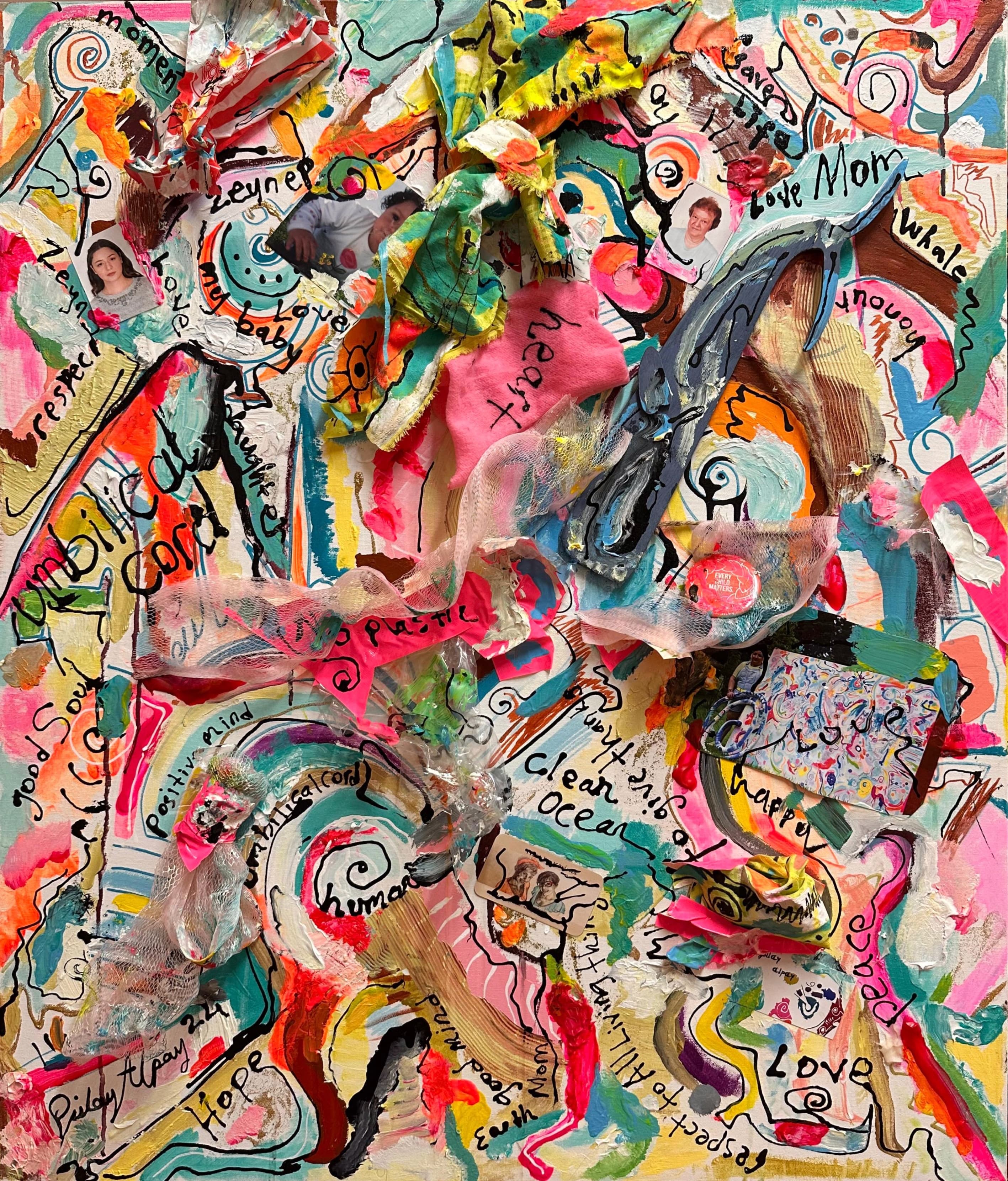 Gulay Alpay Umbilical Cord
